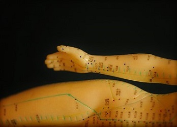 acupuncture