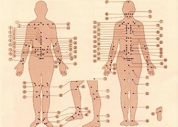 acupuncture